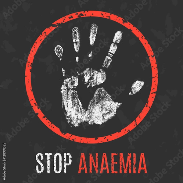 Fototapeta Vector illustration. Human diseases. Stop anaemia.