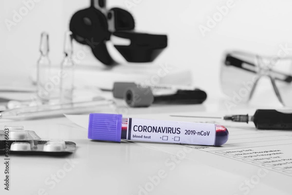 Fototapeta Coronavirus 2019-nCoV concept still life with blood test, drugs and laboratory flasks. COVID-19 background.