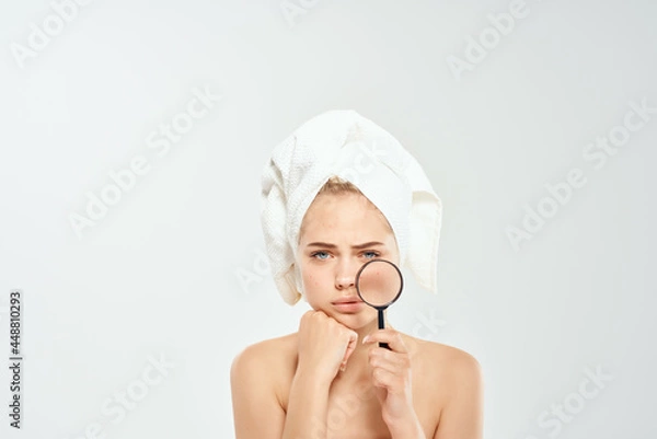 Fototapeta woman with bare shoulders with towels talking skin problems magnifier near face