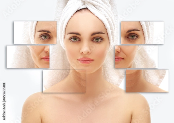 Fototapeta Plastic Surgery Results,Nasolabial folds,Neck ,Under eye circles,neck lines.