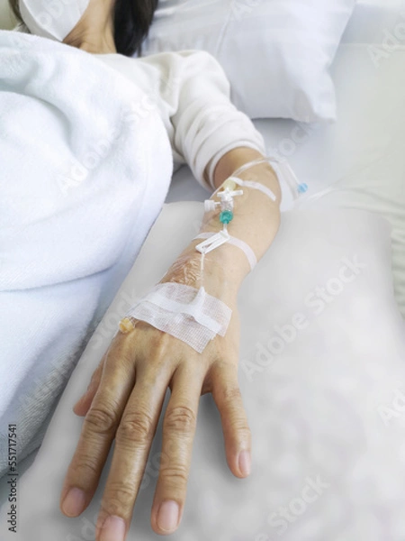 Fototapeta Asian woman patient receiving chemical drugs on drip to blood vessel solution to treat cancer.